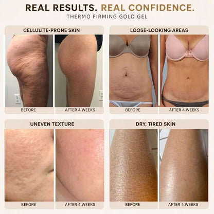 15-Day Visible Firming Gold Gel | Cryo Thermo Anti-Cellulite Body Sculpting Gel | Tighten Loose Skin, Smooth Bumps & Reduce Puffiness for Belly, Thighs & Arms | Unisex 200g