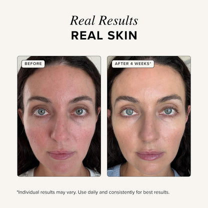 3%GHK-Cu Copper Peptides Firming Serum with 1.5% Hyaluronic Acid | Gentle Anti-Aging Collagen Serum for Sensitive Skin